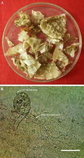 Chytridiomycetes, n                Obelidiumn              , Purified snake skin, Keratinophilic, Chandra Prabha Wildlife Sanctuary