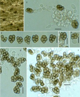 Cheiromycella indica sp. nov. and new records of microfungi from North-Western India  