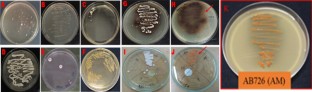 Microbial population, Rhizospheric actinomycetes, Shifting cultivation, Salt-tolerance, PGPR properties, 16SrRNA sequencing