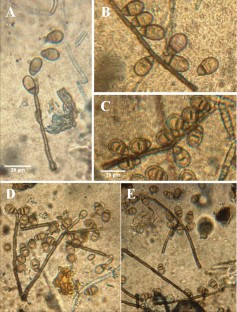 Anamorphic fungi, Asexual fungi, Leaf litter, Saprobic, Hyphomycetes, Taxonomy