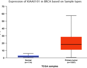 Gene expression and survival analysis study of KIAA0101 gene revealed its prognostic and diagnostic importance in breast cancer  