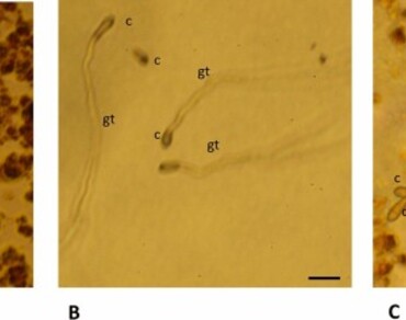 Anthraquinones, Antifungal activity, Extraction process