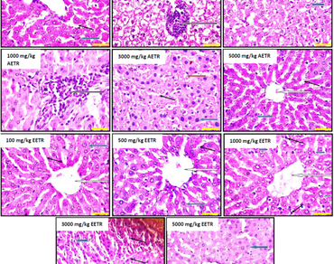 Acute and sub-chronic toxicity studies of aqueous and ethanol extracts of Triumfetta rhomboidea (Tiliaceae) Leaf in healthy albino rats