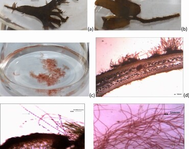 Epiphytic Acrochaetium sp., Seaweed-host nutrient, Phycobilipigments, Anti-oxidant activity, Anti-hyaluronidase