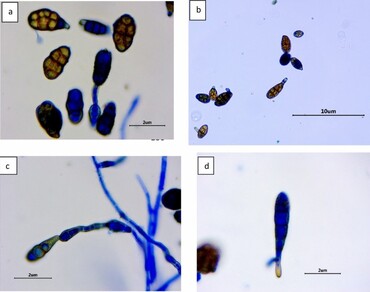 Unique host–pathogen, n                     Abelmoschus esculentusn                  , n                     Alternaria aungustiovoidean                  , Malvaceae, Leaf spot disease