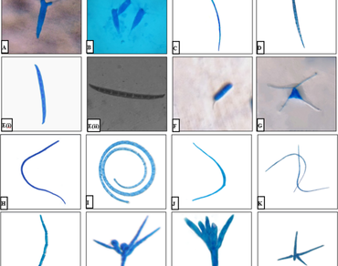 Aquatic hyphomycetes, Root endophytes, New hosts, New record, Nandhaur River