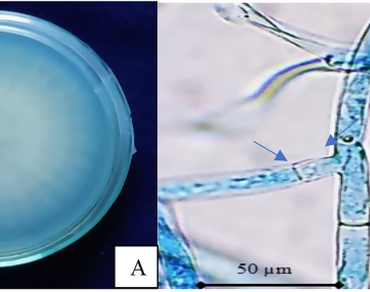 Endophytes. Antibacterial activity. Enzymatic activity. Bergenia ciliatan