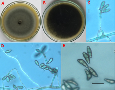 n                     Costus speciosusn                  , Pinpoint disease, n                     Curvularia dactyloctenicolan                  , ITS and GAPDH, Phylogeny