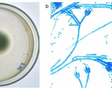 Endophytic fungi, Mangroves, n                     Penicillium rubensn                  , Bioactive compounds, Citrinin