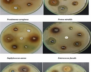 Uropathogens, Multidrug resistance, Antibacterial activity, Phytochemicals, GC–MS, Natural compounds