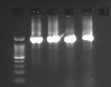 Oranges, Bacterial isolates, Pathogenicity, PCR-DGGE, Biochemical, Postharvest, Decay
