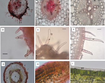 Senna, Anatomy, Trichome, Vascular bundle, Taxonomy