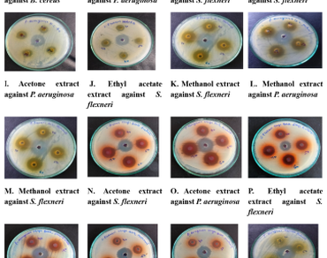 Phytochemical screening, Petroleum ether extract, Antibacterial, MIC, Antioxidant, GC-MS analysis